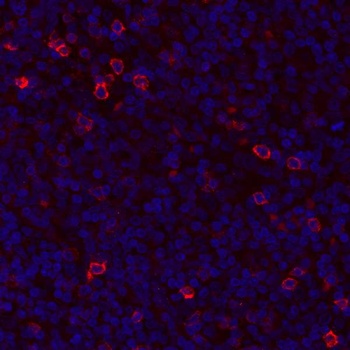 Rabbit GITR/TNFRSF18 Recombinant Monoclonal Antibody