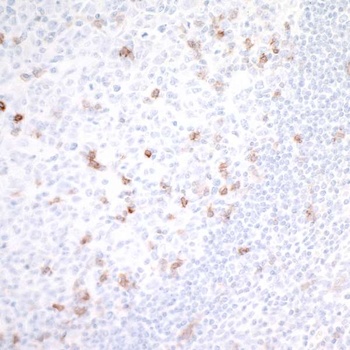 Rabbit GITR/TNFRSF18 Recombinant Monoclonal Antibody