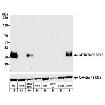Rabbit GITR/TNFRSF18 Recombinant Monoclonal Antibody