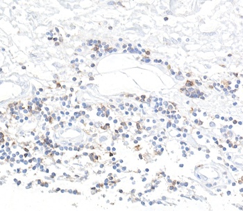 Rabbit CD96 Recombinant Monoclonal Antibody
