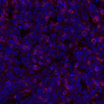 Rabbit anti-TIGIT Recombinant Monoclonal Antibody