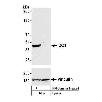 Rabbit IDO1 Recombinant Monoclonal Antibody
