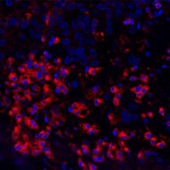 Rabbit anti-VISTA Recombinant Monoclonal Antibody