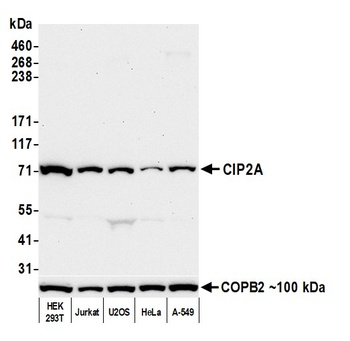 Mouse CIP2A Monoclonal Antibody