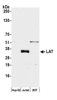 Rabbit LAT Antibody