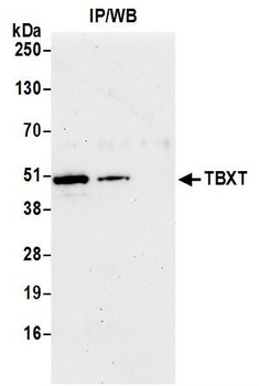 Rabbit TBXT Antibody