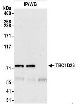 Rabbit TBC1D23 Antibody