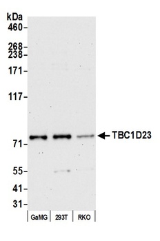 Rabbit TBC1D23 Antibody