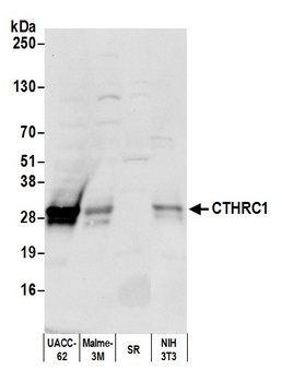 Rabbit CTHRC1 Antibody