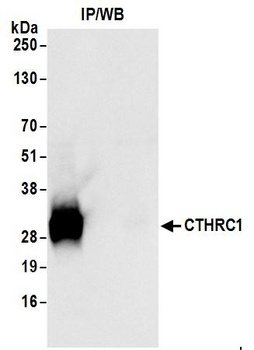 Rabbit CTHRC1 Antibody