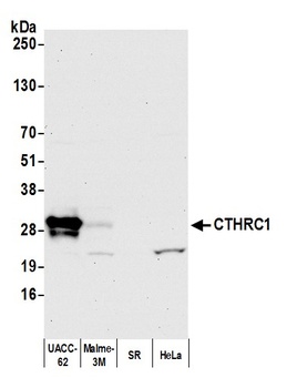 Rabbit CTHRC1 Antibody