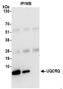 Rabbit UQCRQ Antibody