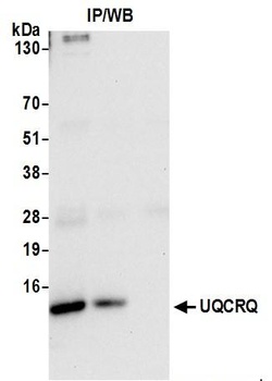 Rabbit UQCRQ Antibody