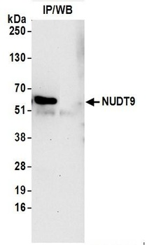 Rabbit NUDT9 Antibody