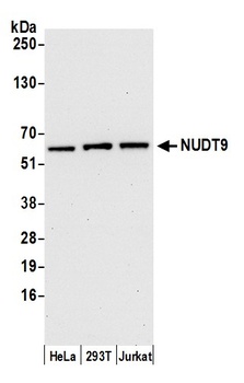 Rabbit NUDT9 Antibody