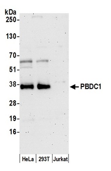 Rabbit PBDC1 Antibody