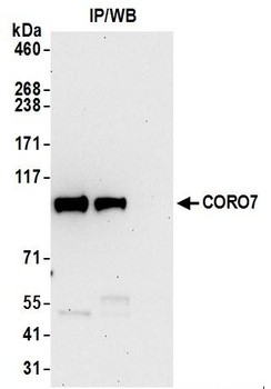 Rabbit CORO7 Antibody