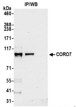Rabbit CORO7 Antibody