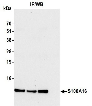 Rabbit S100A16 Antibody