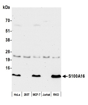 Rabbit S100A16 Antibody