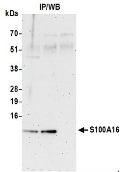 Rabbit S100A16 Antibody