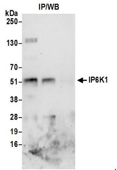 Rabbit IP6K1 Antibody