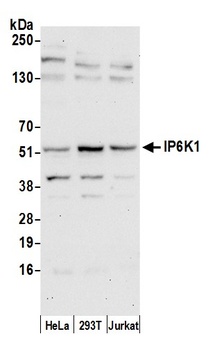 Rabbit IP6K1 Antibody