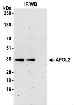 Rabbit APOL2 Antibody