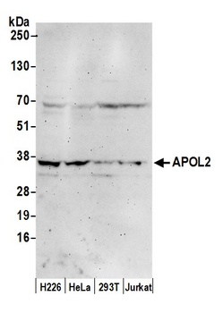 Rabbit APOL2 Antibody