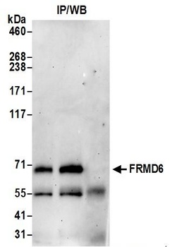 Rabbit FRMD6 Antibody