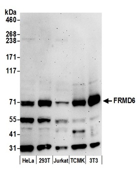 Rabbit FRMD6 Antibody