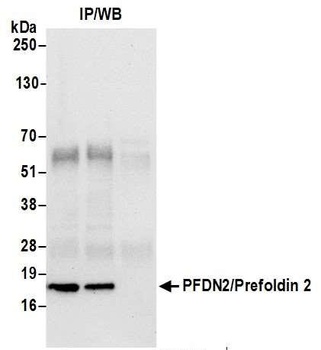 Rabbit PFDN2/Prefoldin 2 Antibody