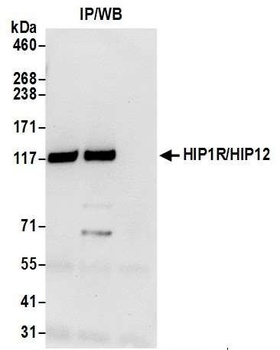 Rabbit HIP1R/HIP12 Antibody