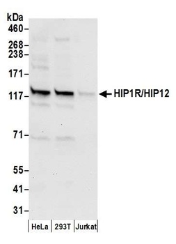 Rabbit HIP1R/HIP12 Antibody