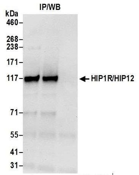 Rabbit HIP1R/HIP12 Antibody