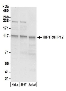 Rabbit HIP1R/HIP12 Antibody