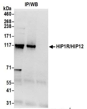 Rabbit HIP1R/HIP12 Antibody
