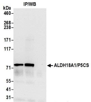 Rabbit ALDH18A1/P5CS Antibody