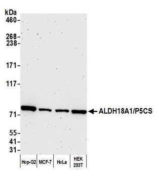 Rabbit ALDH18A1/P5CS Antibody