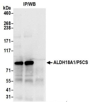 Rabbit ALDH18A1/P5CS Antibody