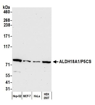 Rabbit ALDH18A1/P5CS Antibody