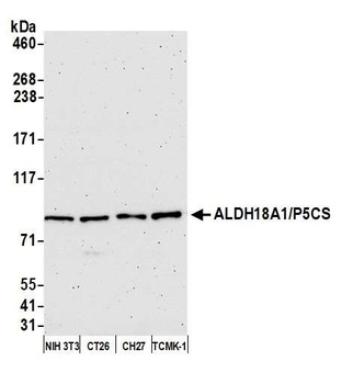 Rabbit ALDH18A1/P5CS Antibody