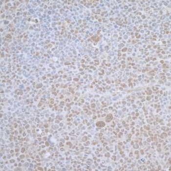 Rabbit TCEB1 Antibody