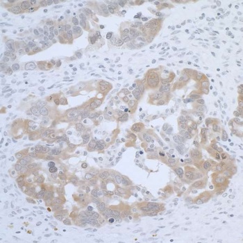 Rabbit CBS Antibody