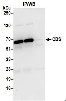 Rabbit CBS Antibody