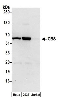 Rabbit CBS Antibody