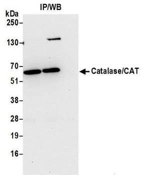 Rabbit Catalase/CAT Antibody
