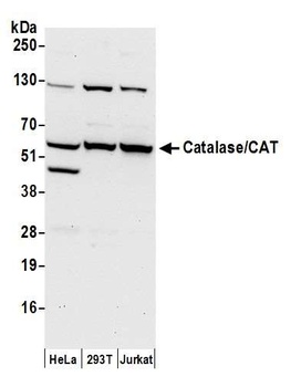 Rabbit Catalase/CAT Antibody