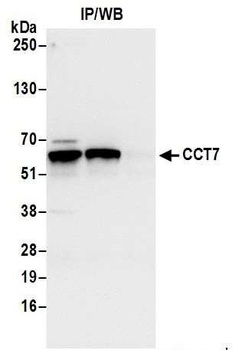 Rabbit CCT7 Antibody
