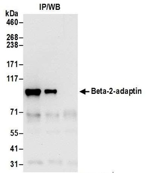 Rabbit Beta-2-adaptin Antibody